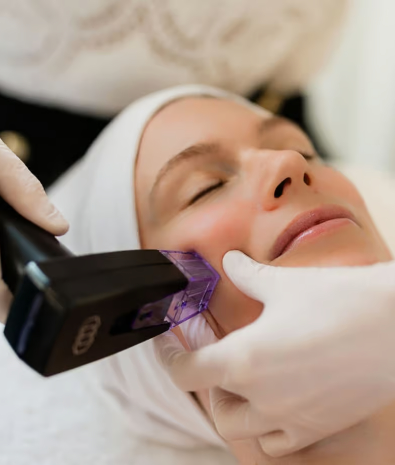 Morpheus8 Face – RF Microneedling & Skin Tightening